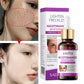 Sadoer  Nicotinamide whitening serum